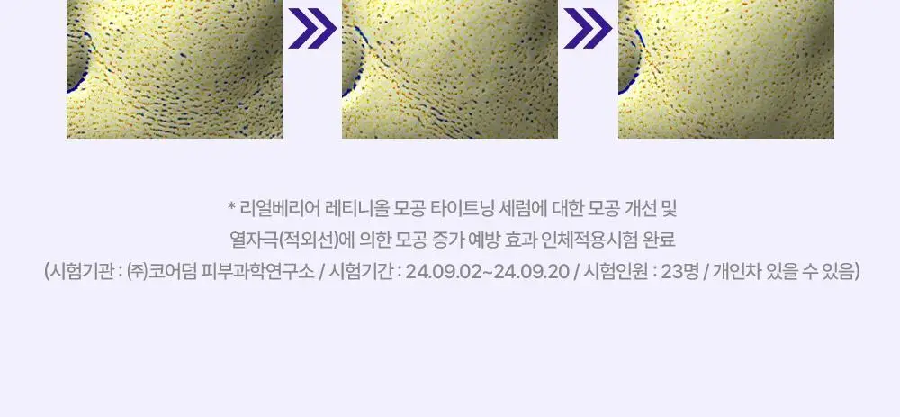 [모공축소] 리얼베리어 레티니올 모공 타이트닝 세럼 30ml 기획 (+10ml) 상세페이지 11